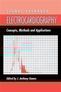 Signal Averaged Electrocardiography