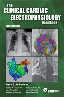 Clinical Cardiac Electrophysiology Handbook, Second Edition