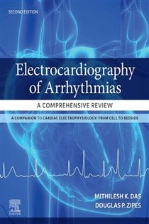 Electrocardiography of Arrhythmias: A Comprehensive Review E-Book