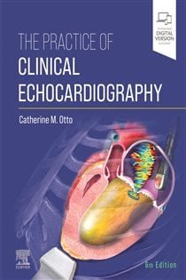 Practice of Clinical Echocardiography E-Book