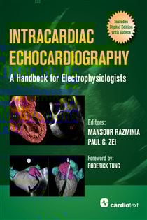 Intracardiac Echocardiography: A Handbook for Electrophysiologists