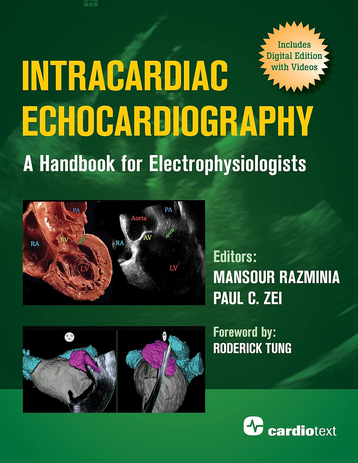 Fluoroscopy Reduction Techniques for Catheter Ablation of Cardiac Arrhythmias 1st Edition