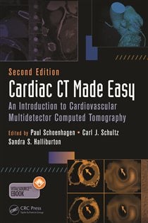 Cardiac CT Made Easy