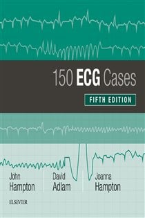 150 ECG Cases