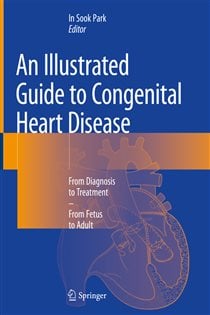 An Illustrated Guide to Congenital Heart Disease