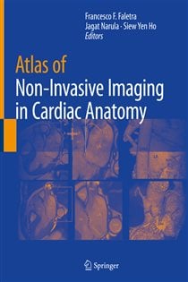 Atlas of Non-Invasive Imaging in Cardiac Anatomy
