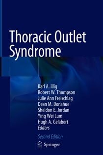 Thoracic Outlet Syndrome