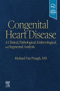 Congenital Heart Disease, E-Book