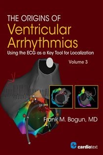 The Origins of Ventricular Arrhythmias: Using the ECG as a Key Tool for Localization, Volume 3