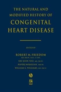 The Natural and Modified History of Congenital Heart Disease