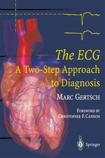 The ECG