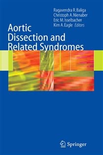 Aortic Dissection and Related Syndromes