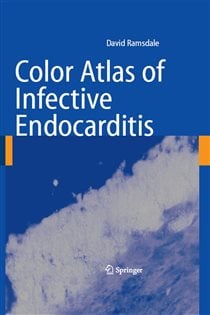 Color Atlas of Infective Endocarditis