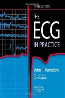 The ECG In Practice E-Book