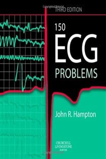 150 ECG Problems E-Book