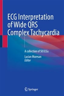 ECG Interpretation of Wide QRS Complex TachycardiaÂ
