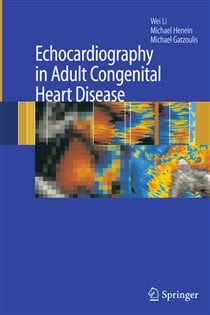 Echocardiography in Adult Congenital Heart Disease