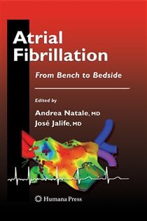 Atrial Fibrillation