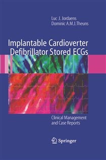 Implantable Cardioverter Defibrillator Stored ECGs