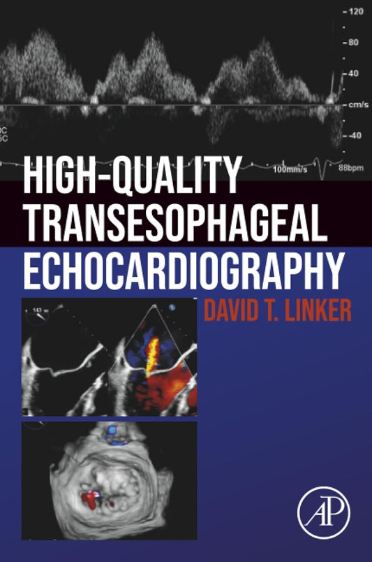 High-Quality Transesophageal Echocardiography 1st Edition