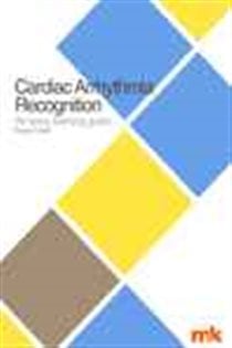 Cardiac Arrhythmia Recognition