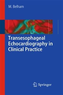 Transesophageal Echocardiography in Clinical Practice